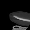 SPORK, NICO - 22.03.1976 - 02.08.2022 - CT obere Extremität - 17:59:38